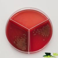 Streptococcus
