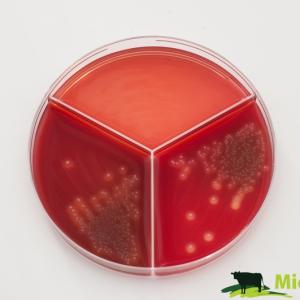 Streptococcus agalactiae