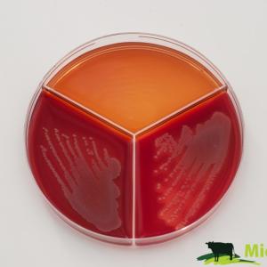 Staphylococcus aureus