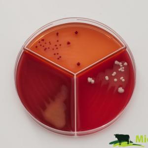 Escherichia coli
